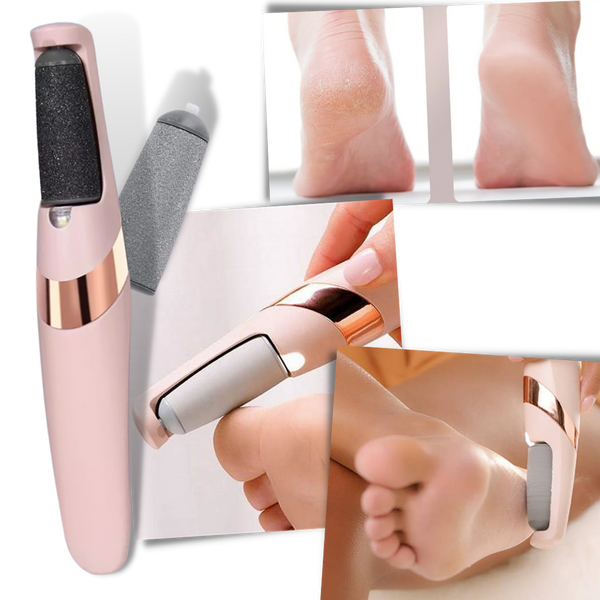 Electric Callus Remover