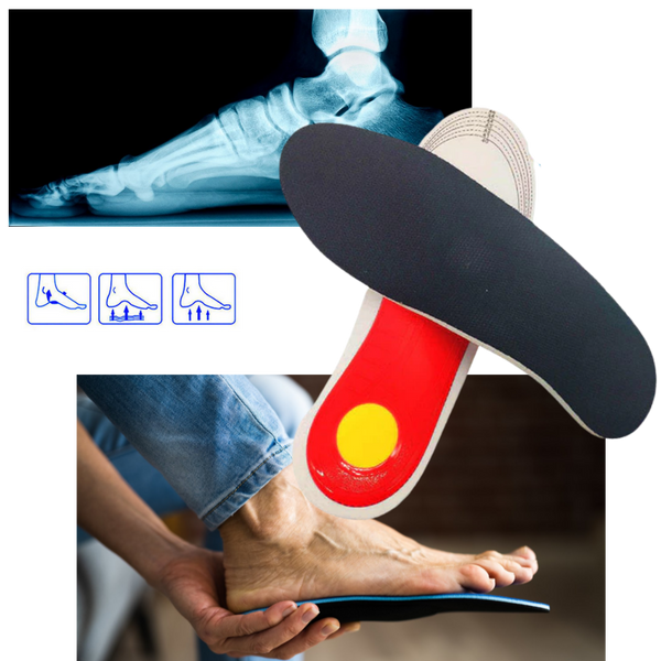 1 Pair of Arch Support Insoles for Flat Feet