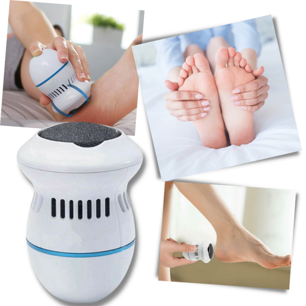 Electric Callus Remover