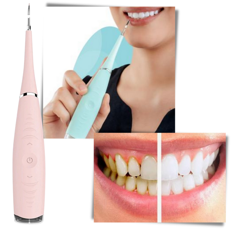 Deep Cleaning Tooth Tartar Machine