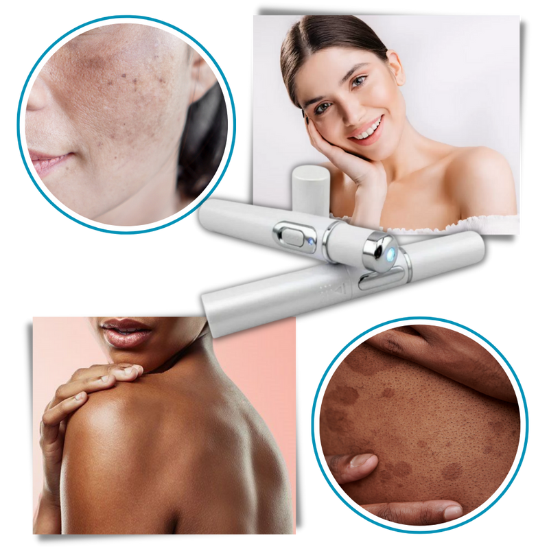 Dark Spot Remover Blue Laser Pen